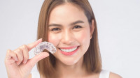 Invisalign & Sure Smile