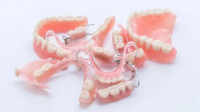 Valplast Partial Dentures