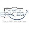 The Art Of Braces