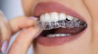 Invisalign For Adults, Teens, and Kids