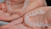 Angel Aligners