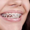 Chapman Smiles