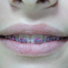 Advanced Orthodontics